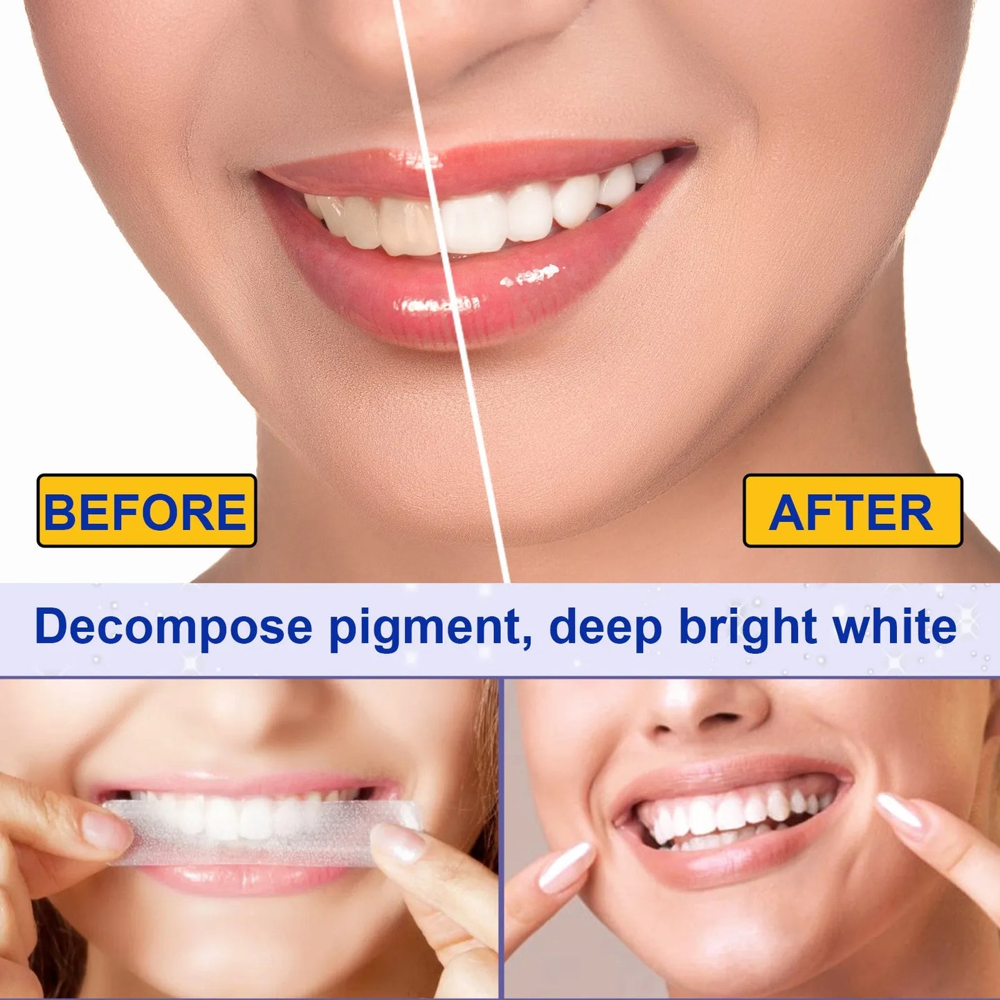 Teeth™  Whitening Strips -