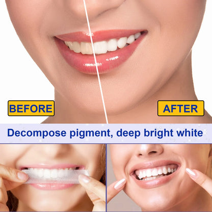 Teeth™  Whitening Strips -