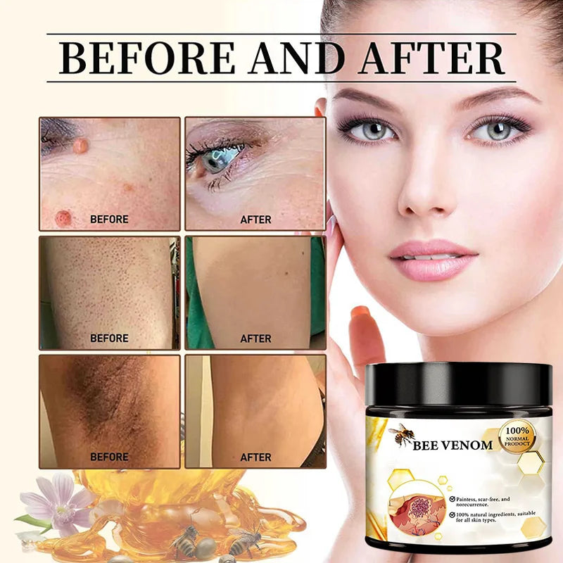 🐝 60g Bee Venom Wart Remover – Soothes & Repairs!