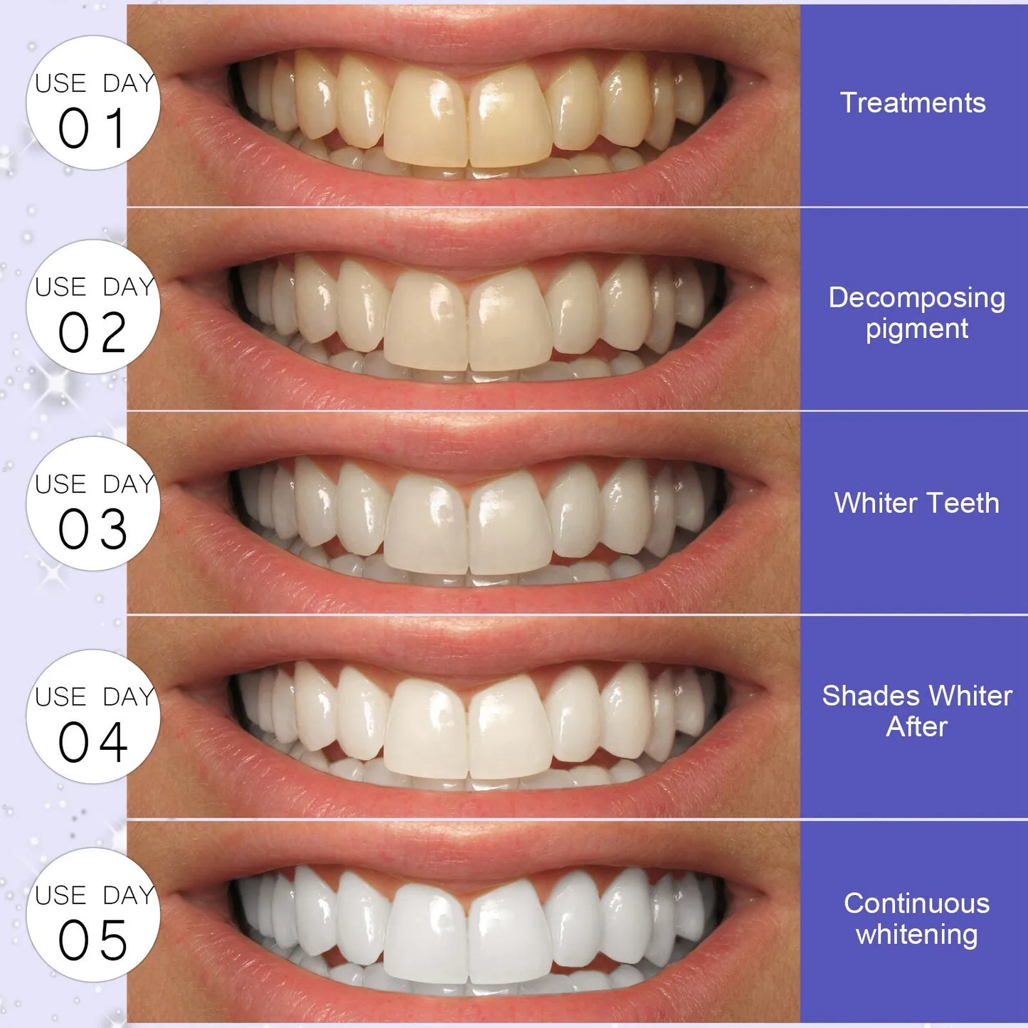 Teeth™  Whitening Strips -