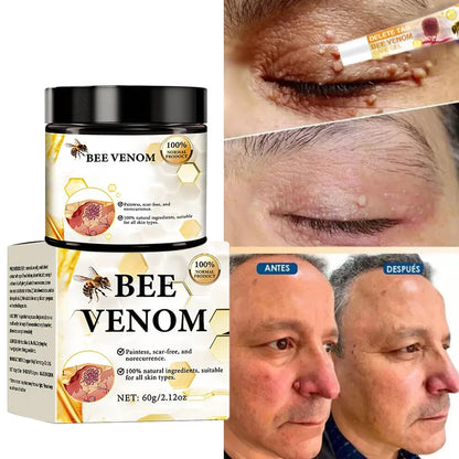 🐝 60g Bee Venom Wart Remover – Soothes & Repairs!